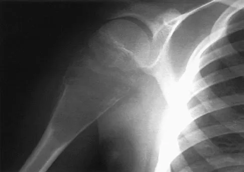 Sports Medicine 2004 Practice Questions: Set 3 (Solved) - Figure 9