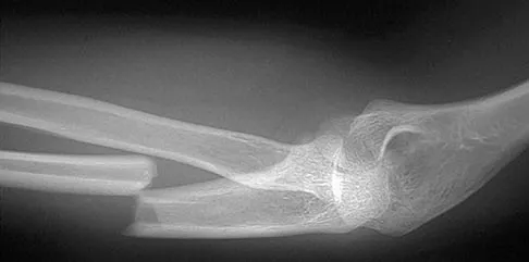 Sports Medicine Board Review 2004: High-Yield MCQs (Set 4) - Figure 4