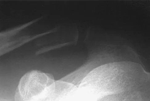 Sports Medicine Board Review 2004: High-Yield MCQs (Set 4) - Figure 6