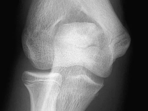 Sports Medicine Board Review 2004: High-Yield MCQs (Set 4) - Figure 8