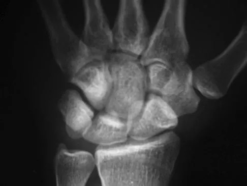 Sports Medicine 2007 Practice Questions: Set 1 (Solved) - Figure 13