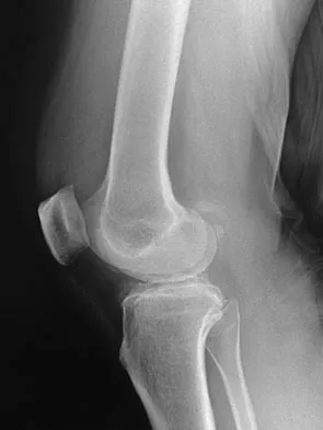 Sports Medicine 2007 Practice Questions: Set 1 (Solved) - Figure 15