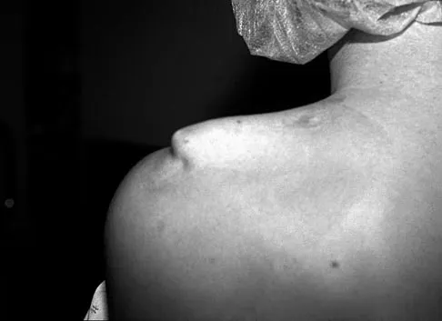 Sports Medicine 2007 Practice Questions: Set 1 (Solved) - Figure 16