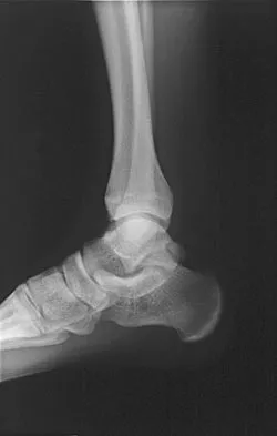 Sports Medicine 2007 Practice Questions: Set 1 (Solved) - Figure 18