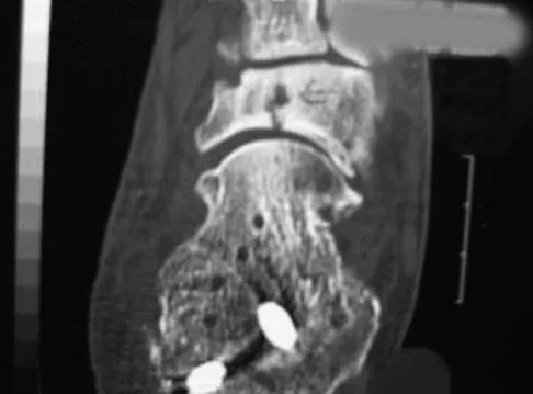 Sports Medicine 2007 Practice Questions: Set 1 (Solved) - Figure 22