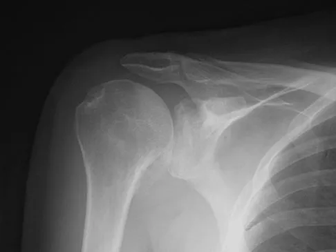 Sports Medicine 2007 Practice Questions: Set 1 (Solved) - Figure 23