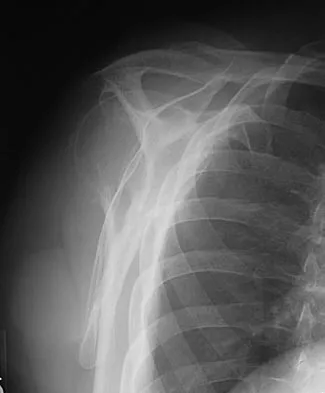 Sports Medicine 2007 Practice Questions: Set 1 (Solved) - Figure 25