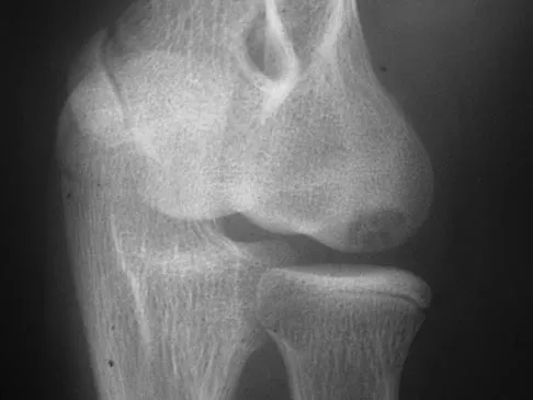 Sports Medicine 2007 Practice Questions: Set 1 (Solved) - Figure 26