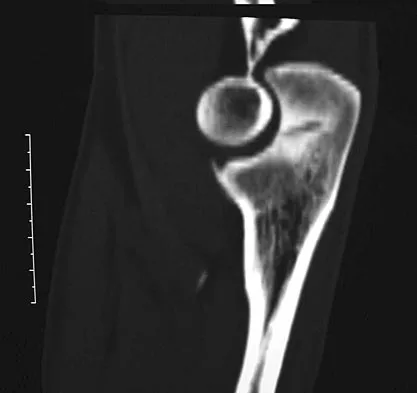Sports Medicine 2007 Practice Questions: Set 1 (Solved) - Figure 27