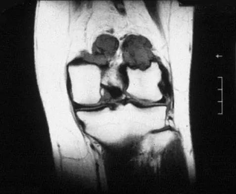 Sports Medicine 2007 Practice Questions: Set 1 (Solved) - Figure 5