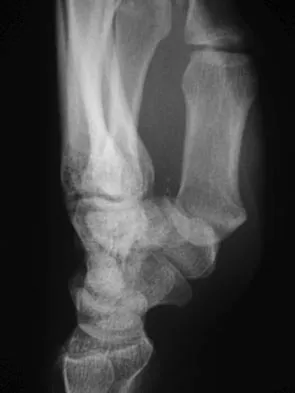 Sports Medicine Board Review 2007: High-Yield MCQs (Set 2) - Figure 10