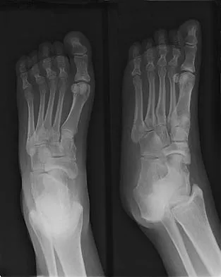 Sports Medicine Board Review 2007: High-Yield MCQs (Set 2) - Figure 12