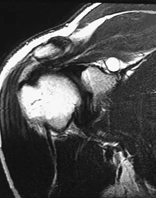 Sports Medicine 2007 Practice Questions: Set 3 (Solved) - Figure 1