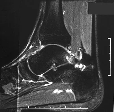 Sports Medicine 2007 Practice Questions: Set 3 (Solved) - Figure 5