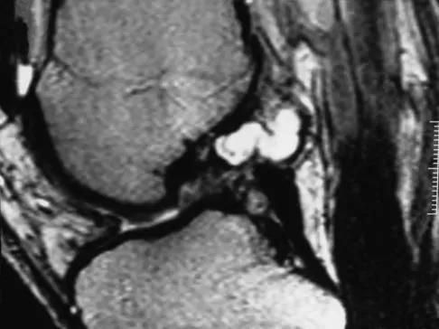 Sports Medicine 2007 Practice Questions: Set 3 (Solved) - Figure 8