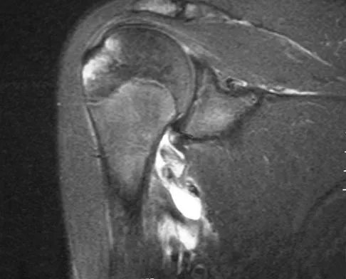 Sports Medicine Board Review 2007: High-Yield MCQs (Set 4) - Figure 10