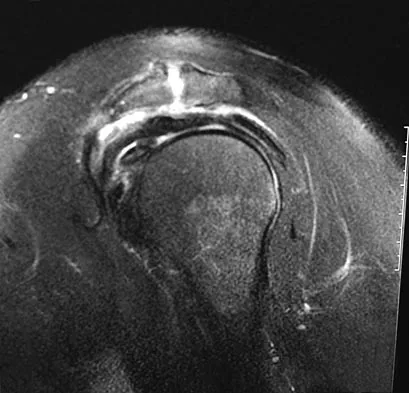 Sports Medicine Board Review 2007: High-Yield MCQs (Set 4) - Figure 9