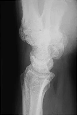 Sports Medicine 2026 MCQs: Board Review Questions & Answers (Part 1) - Figure 25