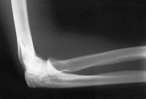 Sports Medicine 2026 MCQs: Board Review Questions & Answers (Part 1) - Figure 39