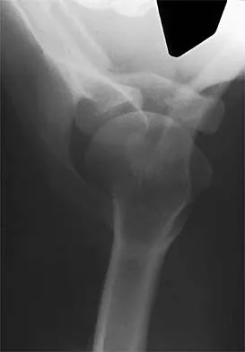 Sports Medicine 2026 MCQs: Board Review Questions & Answers (Part 1) - Figure 43