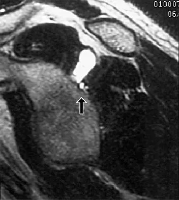 Sports Medicine 2026 MCQs: Board Review Questions & Answers (Part 1) - Figure 53