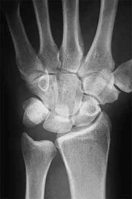 Sports Medicine 2026 MCQs: Board Review Questions & Answers (Part 1) - Figure 57