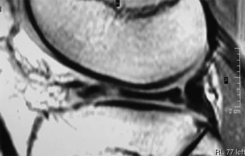 Sports Medicine 2026 MCQs: Board Review Questions & Answers (Part 1) - Figure 7