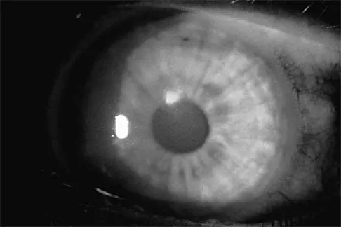 Sports Medicine 2026 MCQs: Board Review Questions & Answers (Part 1) - Figure 73