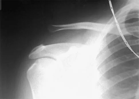 Sports Medicine 2026 MCQs: Board Review Questions & Answers (Part 1) - Figure 75