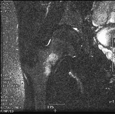 Sports Medicine 2026 MCQs: Board Review Questions & Answers (Part 1) - Figure 85