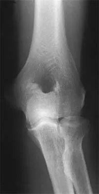 Sports Medicine 2026 MCQs: Board Review Questions & Answers (Part 1) - Figure 97