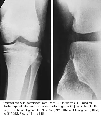 Sports Medicine 2026 MCQs: Board Review Questions & Answers (Part 2) - Figure 21