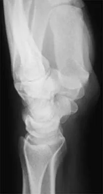 Sports Medicine 2026 MCQs: Board Review Questions & Answers (Part 2) - Figure 25