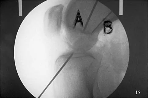 Sports Medicine 2026 MCQs: Board Review Questions & Answers (Part 2) - Figure 41