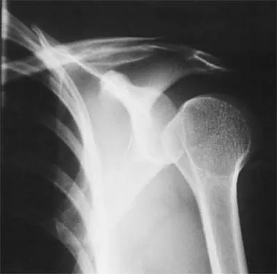 Sports Medicine 2026 MCQs: Board Review Questions & Answers (Part 2) - Figure 47