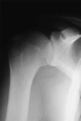 Sports Medicine 2026 MCQs: Board Review Questions & Answers (Part 2) - Figure 49