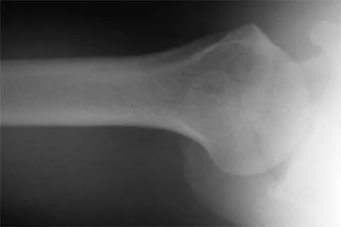 Sports Medicine 2026 MCQs: Board Review Questions & Answers (Part 2) - Figure 51