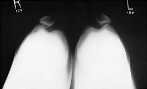 Sports Medicine 2026 MCQs: Board Review Questions & Answers (Part 2) - Figure 65