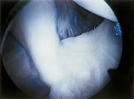 Sports Medicine 2026 MCQs: Board Review Questions & Answers (Part 2) - Figure 7