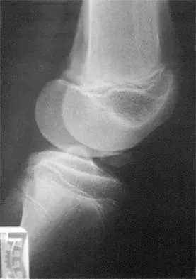 Sports Medicine 2026 MCQs: Board Review Questions & Answers (Part 2) - Figure 77