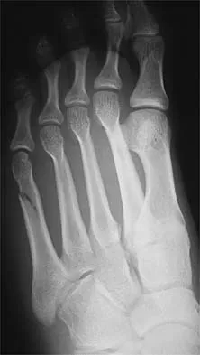 Sports Medicine 2026 MCQs: Board Review Questions & Answers (Part 2) - Figure 9