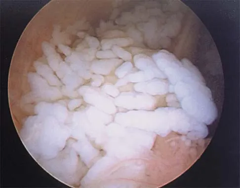 Sports Medicine 2026 MCQs: Board Review Questions & Answers (Part 4) - Figure 19