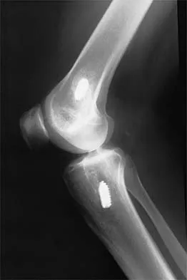 Sports Medicine 2026 MCQs: Board Review Questions & Answers (Part 4) - Figure 23