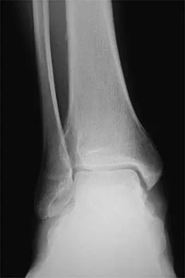 Sports Medicine 2026 MCQs: Board Review Questions & Answers (Part 4) - Figure 27