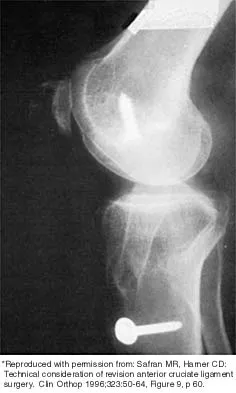 Sports Medicine 2026 MCQs: Board Review Questions & Answers (Part 4) - Figure 31