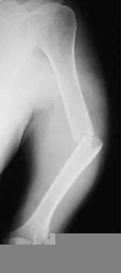 Trauma 2000 Practice Questions: Set 3 (Solved) Figure 1