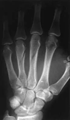 Click to enlarge Trauma 2000 Practice Questions: Set 1 (Solved) - Figure 20