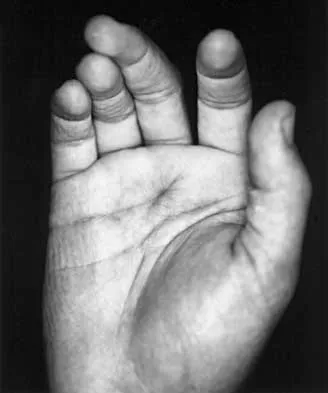 Click to enlarge Trauma 2000 Practice Questions: Set 1 (Solved) - Figure 21