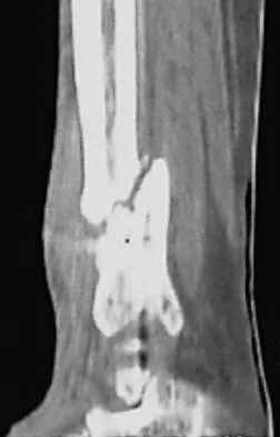 Trauma 2000 Practice Questions: Set 1 (Solved) - Figure 26