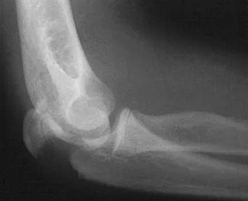 Trauma 2000 Practice Questions: Set 1 (Solved) - Figure 4